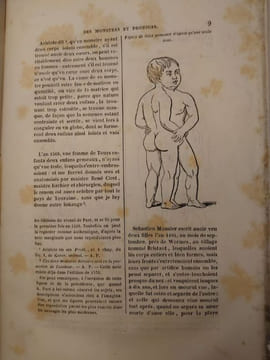 Oeuvres complètes d'Ambroise Paré. Revues et collationnées sur toutes les éditions, avec les varinates. Ornées de 217 planches et du portrait de ...