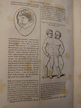 Oeuvres complètes d'Ambroise Paré. Revues et collationnées sur toutes les éditions, avec les varinates. Ornées de 217 planches et du portrait de ...