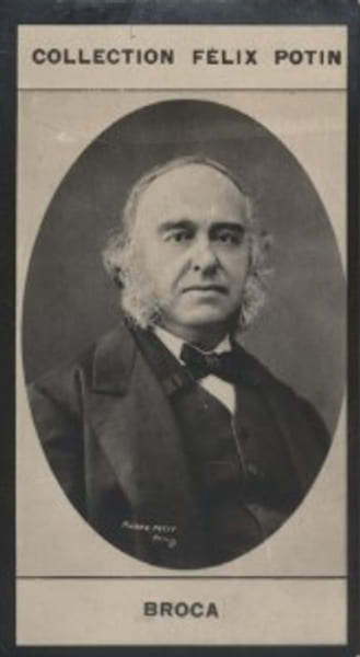 Photographie de la collection F&eacute;lix Potin (4 x 7,5 cm) repr&eacute;sentant : Paul Broca, m&eacute;decin.. BROCA (Paul) Photo Pierre Petit.