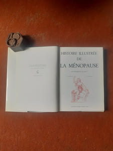 Histoire illustrée de la ménopause, de l'Antiquité à nos jours