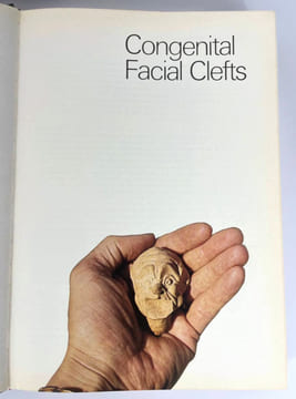 Plastic Surgery: New Methods And Refinements. Tord Gustav Skoog