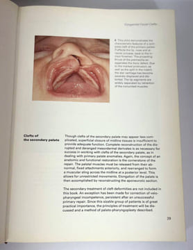 Plastic Surgery: New Methods And Refinements. Tord Gustav Skoog
