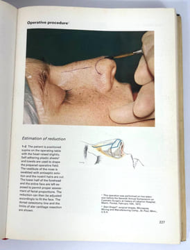 Plastic Surgery: New Methods And Refinements. Tord Gustav Skoog