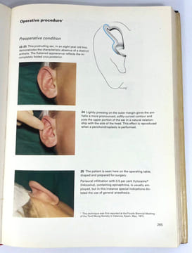 Plastic Surgery: New Methods And Refinements. Tord Gustav Skoog