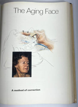Plastic Surgery: New Methods And Refinements. Tord Gustav Skoog