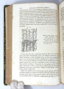 Éléments de pathologie chirurgicale générale. Théodore Billroth