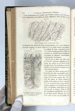 Éléments de pathologie chirurgicale générale. Théodore Billroth