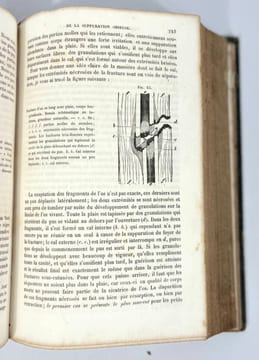 Éléments de pathologie chirurgicale générale. Théodore Billroth