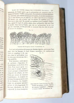 Éléments de pathologie chirurgicale générale. Théodore Billroth