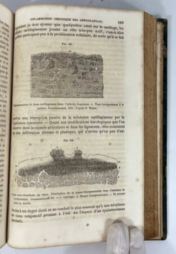 Éléments de pathologie chirurgicale générale. Théodore Billroth