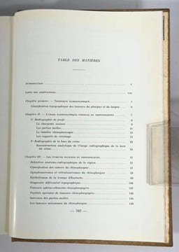 Tumeurs malignes du pharynx et du larynx. Étude anatomo-topographique et radiographique. F. Baclesse