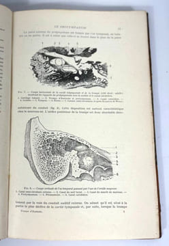 La trompe d'Eustache. J. Terracol, A. Corone et Y. Guerrier