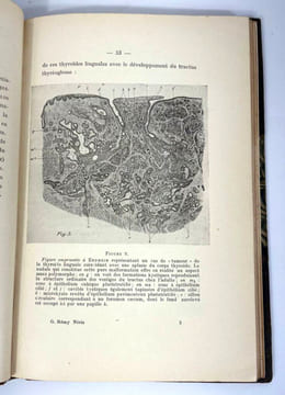 Le tractus thyréoglosse. Embryologie topogographique, pathologie chirurgicale, kystes, fistules et tumeurs. G. Rémy Néris