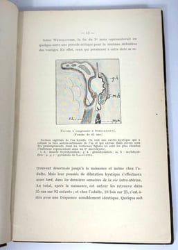Le tractus thyréoglosse. Embryologie topogographique, pathologie chirurgicale, kystes, fistules et tumeurs. G. Rémy Néris