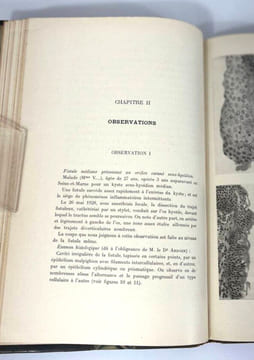 Le tractus thyréoglosse. Embryologie topogographique, pathologie chirurgicale, kystes, fistules et tumeurs. G. Rémy Néris