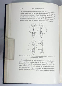 Clinics of George W. Crile & associates. The Thyroid Gland