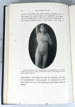 Clinics of George W. Crile & associates. The Thyroid Gland