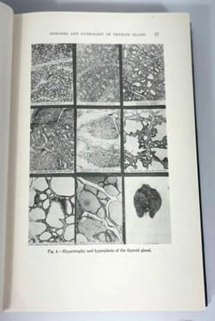 Clinics of George W. Crile & associates. The Thyroid Gland
