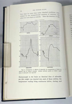 Clinics of George W. Crile & associates. The Thyroid Gland