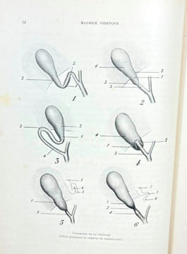 Chirurgie des voies biliaires. Henri Hartmann et al.