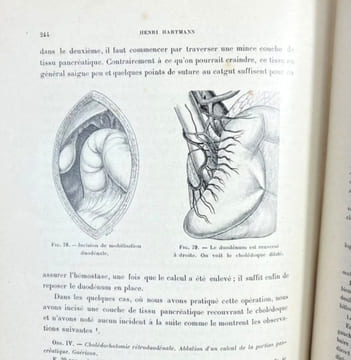 Chirurgie des voies biliaires. Henri Hartmann et al.