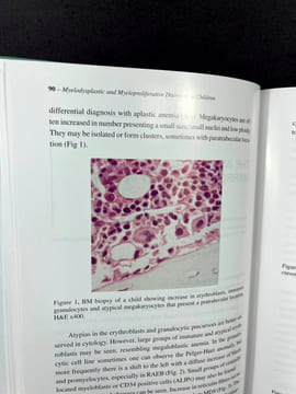Myelodysplastic and Myeloproliferative Disorders in Childen. Luiz Fernando Lopes, Henrik Hasle (eds)