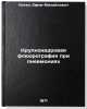 Krupnokadrovaya flyuorografiya pri pnevmoniyakh. In Russian . Kagan, Efim Mikhailovich