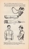 Manual of Artificial Limbs... Artificial Toes, Feet, Legs, Fingers, Hands, Arms, for Amputations and Deformities, Appliances for Excisions, Fractures, ...