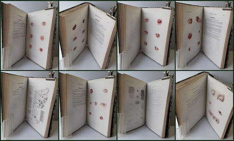 ATLAS pour l'Iconographie ophthalmologique ou description, avec figures coloriées, des maladies de l’organe de la vue comprenant l’anatomie ...