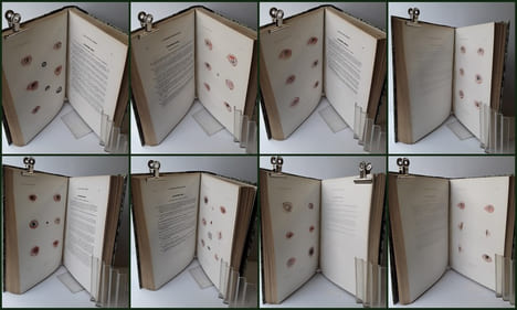ATLAS pour l'Iconographie ophthalmologique ou description, avec figures coloriées, des maladies de l’organe de la vue comprenant l’anatomie ...