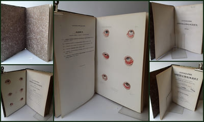 ATLAS pour l'Iconographie ophthalmologique ou description, avec figures coloriées, des maladies de l’organe de la vue comprenant l’anatomie pathologique, la pathologie et la thérapeutique médico-chirurgicales [...]