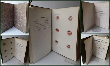 ATLAS pour l'Iconographie ophthalmologique ou description, avec figures coloriées, des maladies de l’organe de la vue comprenant l’anatomie ...