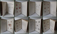 ATLAS pour l'Iconographie ophthalmologique ou description, avec figures coloriées, des maladies de l’organe de la vue comprenant l’anatomie pathologique, la pathologie et la thérapeutique médico-chirurgicales [...]