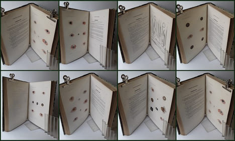ATLAS pour l'Iconographie ophthalmologique ou description, avec figures coloriées, des maladies de l’organe de la vue comprenant l’anatomie ...