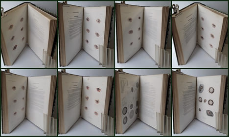 ATLAS pour l'Iconographie ophthalmologique ou description, avec figures coloriées, des maladies de l’organe de la vue comprenant l’anatomie ...