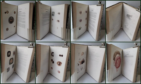 ATLAS pour l'Iconographie ophthalmologique ou description, avec figures coloriées, des maladies de l’organe de la vue comprenant l’anatomie ...
