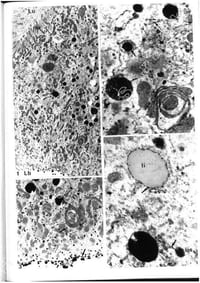 Les tubes de Malpighi chez les diptères supérieurs. Leur évolution structurale et physiologique pendant la vie post-embryonnaire chez Calliphora erythtocephala Meigen. Leur signification taxinomique chez les Drosophilidae. 2 volumes.