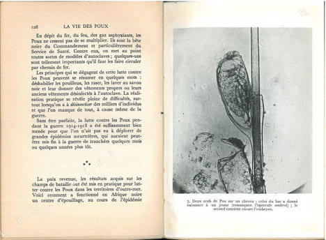 La vie des poux.. Mathis, Maurice