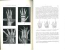 La main des lémuriens malgaches comparée à celle des autres primates.. Jouffroy, F.K. & J. Lessertisseur