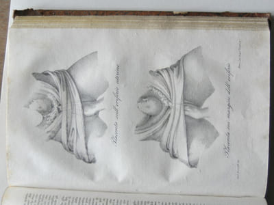 Corso teorico e pratico di Otetricia nel quale si espongono i principi di questo ramo dell'arte snatrice, le cure richieste dalla donna durante e dopo il parto...