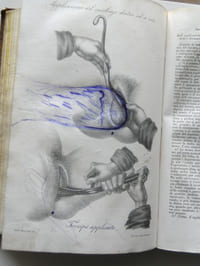 Corso teorico e pratico di Otetricia nel quale si espongono i principi di questo ramo dell'arte snatrice, le cure richieste dalla donna durante e dopo il parto...
