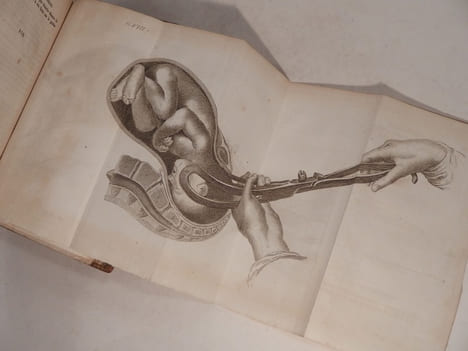 L'Art des accouchemens. 4e édition, revue, corrigée et augmentée. Avec figures en taille-douce.. BAUDELOCQUE (J. L.)