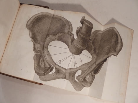 L'Art des accouchemens. 4e édition, revue, corrigée et augmentée. Avec figures en taille-douce.. BAUDELOCQUE (J. L.)