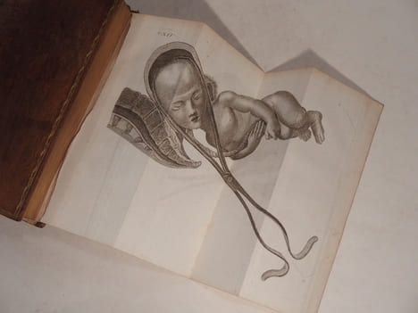 L'Art des accouchemens. 4e édition, revue, corrigée et augmentée. Avec figures en taille-douce.. BAUDELOCQUE (J. L.)