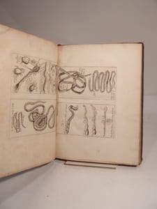 Vers solitaires et autres de diverses espèces, dont il est traité dans le livre De la Génération des Vers représentez en plusieurs planches, avec les renvois aux pages où il en est parlé, ou qui y ont rapport : ensemble, plusieurs remarques importantes sur ce sujet. 