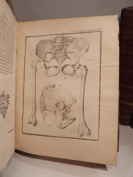 Mémoires de l'Académie de Chirurgie. Tomes 1 à 5.. LA PEYRONIE, QUESNAY, PETIT, DU FOUART, LA FAYE, GARENGEOT, FOUBERT, LA MARTINIERE, LOUIS, ...