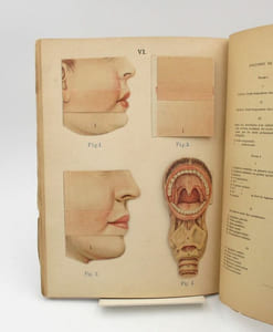 Anatomie et physiologie du corps humain. Atlas de sept planches coloriées à feuillets découpés et superposés avec notices descriptives
