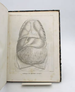 Traité d'anatomie descriptive. Splanchnologie planches