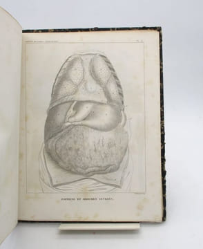Traité d'anatomie descriptive. Splanchnologie planches. CLOQUET (Hippolyte)