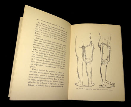 INDICATIONS GÉNÉRALES DU TRAITEMENT DES PLAIES DE GUERRE
suivies de quelques médications à l'usage des blessés, la localisation des corps étrangers, ...
